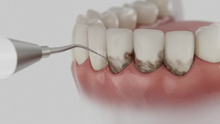 Trusted Emergency Dentist service in Jonesboro, LA - Dentist Open Now